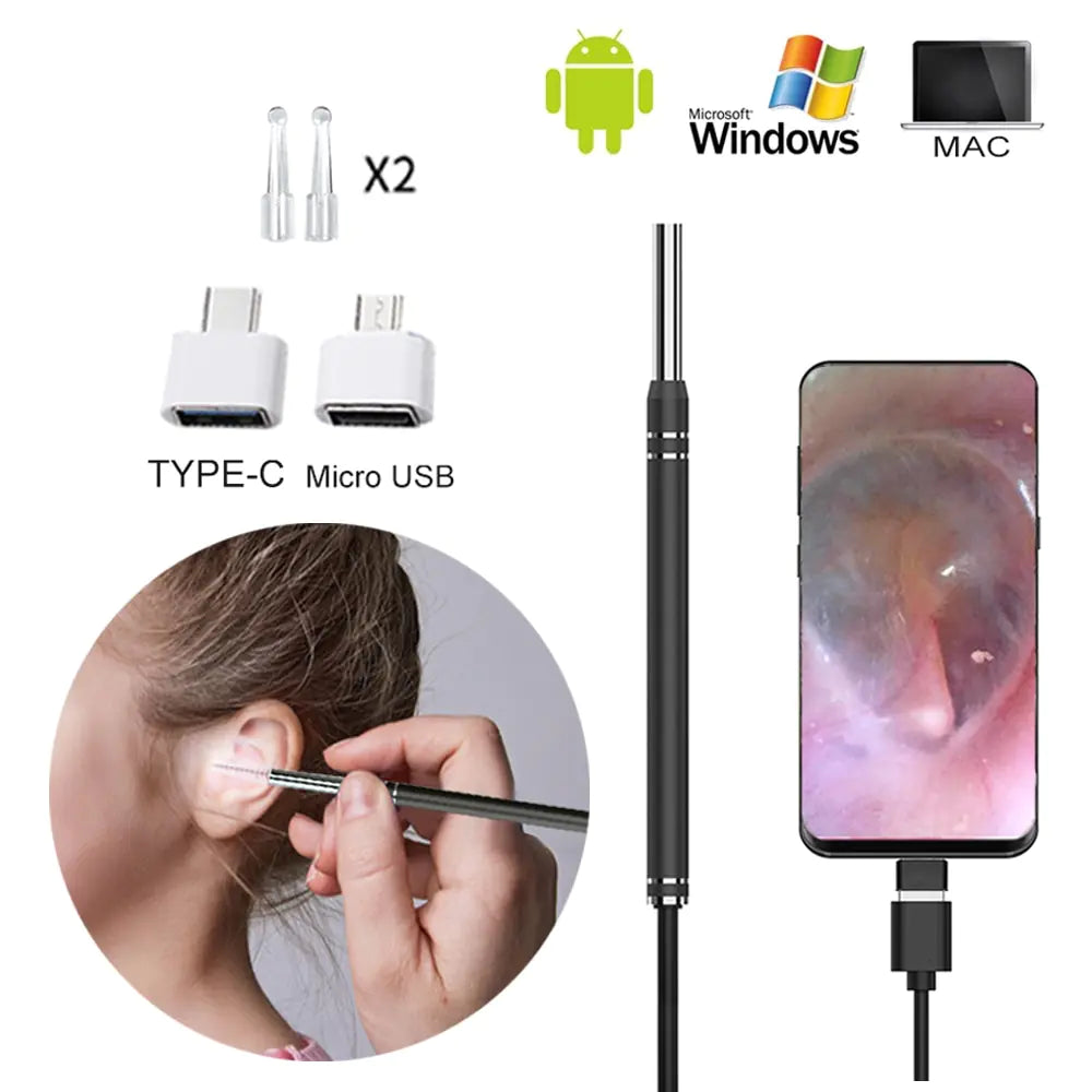 Smart Earwax Removal Tool w/ Camera - fashion finesse accessories